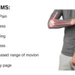 Attrities: Understanding Arthritis, Symptoms, and Treatments